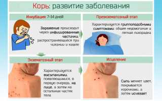 Хронический фаринголарингит: симптомы и лечение