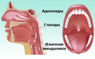 Чем отличается лакунарная ангина от фолликулярной? Важные аспекты