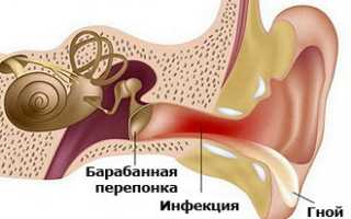 Выделения из уха у ребенка: причины и лечение