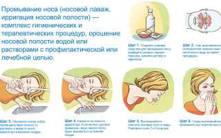 Как промыть ребенку нос перекисью водорода для здоровья