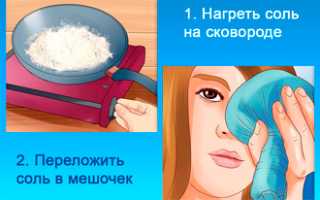 Можно ли греть нос при насморке солью для облегчения симптомов