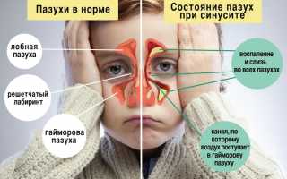 Доктор Комаровский о гайморите у детей: советы и рекомендации