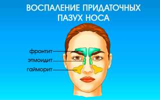 Лучшие назальные препараты в аэрозольной форме с антибиотиками для здоровья