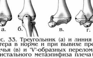 Сколько времени заживает растяжение связок голеностопа?