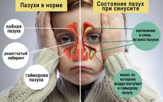 Как правильно промывать нос при гайморите для эффективного лечения?