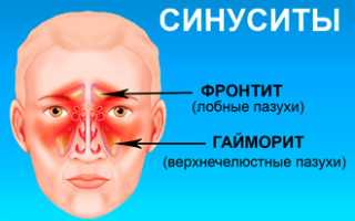 Лечение гипертрофического ринита: методы и рекомендации