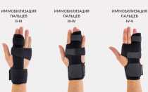 Как подобрать и носить ортез на пальцы руки?