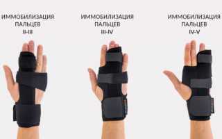 Как подобрать и носить ортез на пальцы руки?