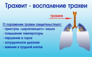 Трахеит у взрослых: симптомы и лечение