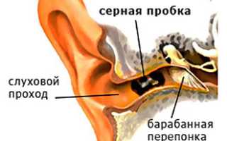 Давление в ушах: причины и способы устранения
