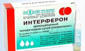 Герпесная ангина — лечение у взрослых и профилактика