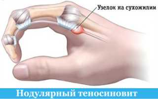 Боль в указательном пальце на руке: заболевания, симптоматика и лечение