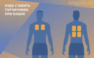 Лечение трахеита при помощи горчичников в домашних условиях