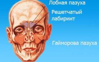 Боли гайморовых пазух при отсутствии насморка: причины и лечение