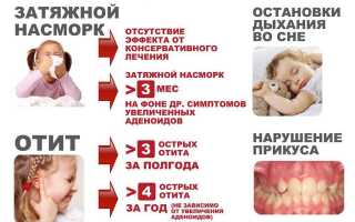 Гнойный аденоидит у ребенка: симптомы и лечение