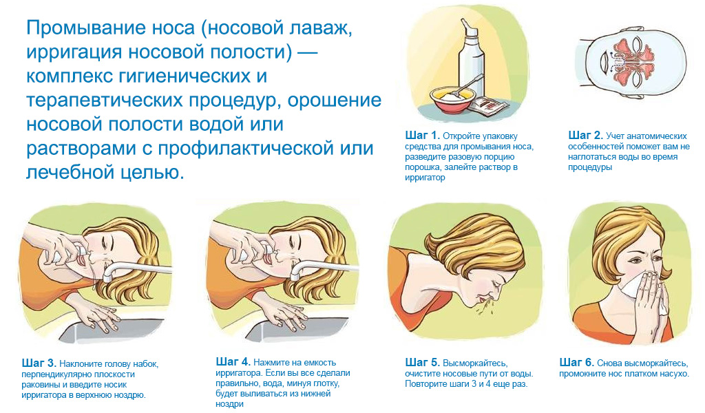 Схема промывания