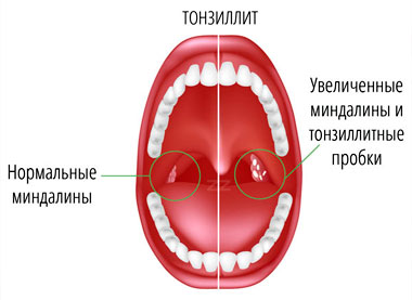 Схема