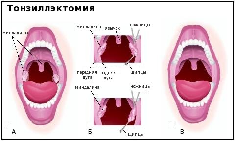 Схема