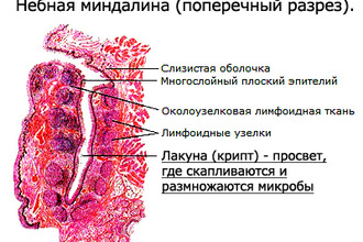 Лакуны