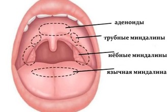 Миндалины