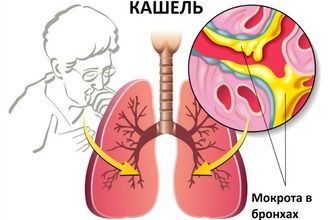 Мокрота