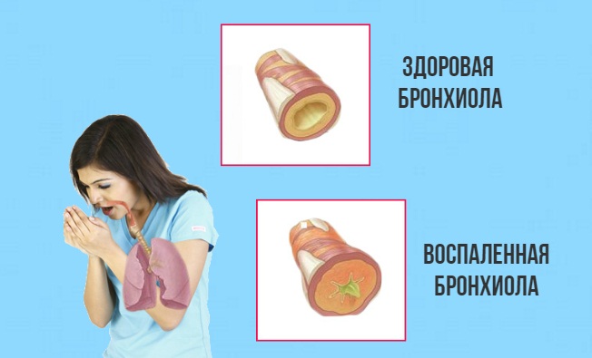 причины