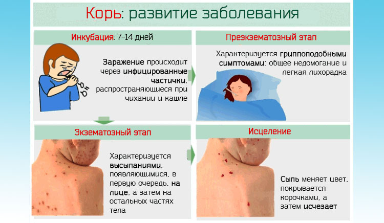 Корь