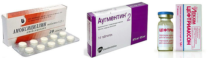 Антибактериальные препараты
