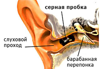 Причины