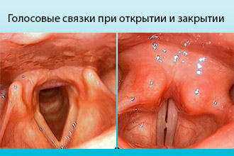 Голосовые связки при открытии и закрытии