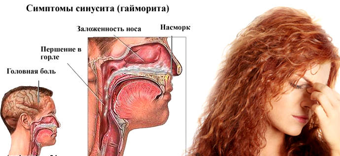 Симптомы болезни