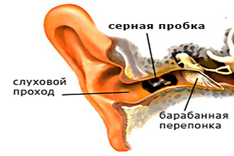 Серная пробка