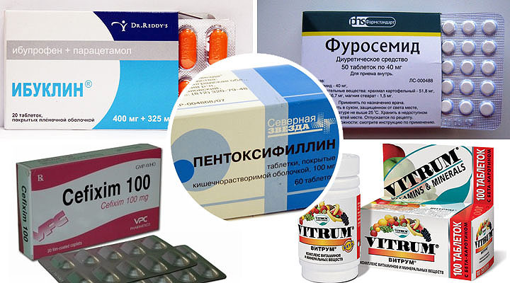 Консервативное лечение