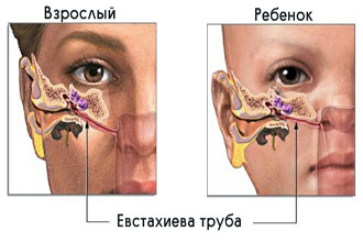 Механизм болезни