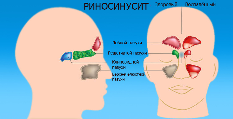 Причины боли
