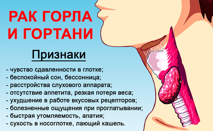 Рак горла