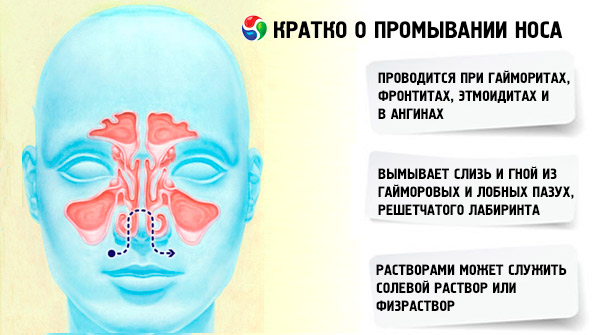Схема