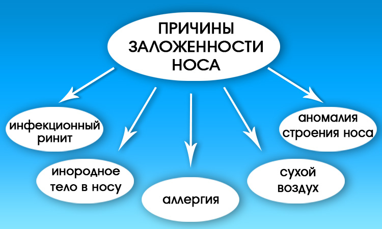 Причины заложенности носа